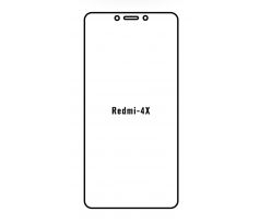 Hydrogel - Privacy Anti-Spy ochranná fólie - Xiaomi Redmi 4X