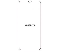 Hydrogel - Privacy Anti-Spy ochranná fólie - Huawei Honor X6