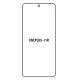Hydrogel - matná ochranná fólie - OnePlus 11R