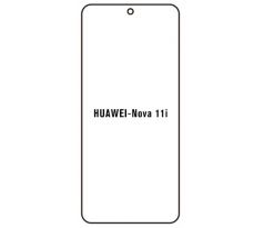 Hydrogel - Privacy Anti-Spy ochranná fólie - Huawei Nova 11i