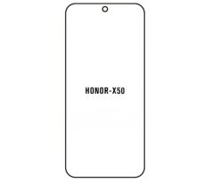 UV Hydrogel s UV lampou - ochranná fólie - Huawei Honor X50
