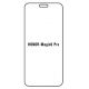 Hydrogel - ochranná fólie - Huawei Honor Magic6 Pro (case friendly)  