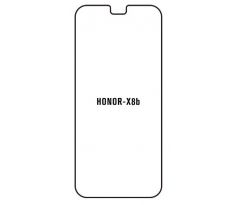 Hydrogel - ochranná fólie - Huawei Honor X8b (case friendly)