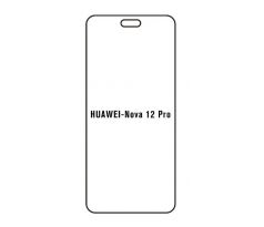 Hydrogel - Privacy Anti-Spy ochranná fólie - Huawei Nova 12 Pro