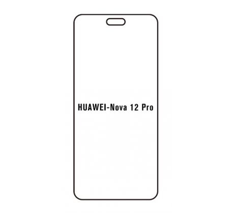 Hydrogel - Privacy Anti-Spy ochranná fólie - Huawei Nova 12 Pro