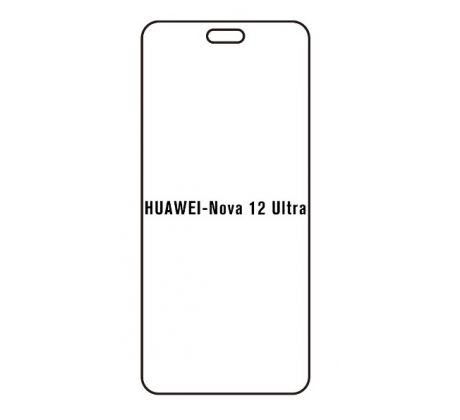 Hydrogel - ochranná fólie - Huawei Nova 12 Ultra (case friendly) 